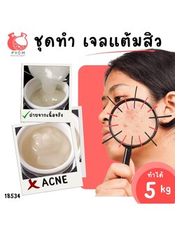 18534 ชุดทำ แอคเน่สปอตเจล เจลแต้มสิว-5kg