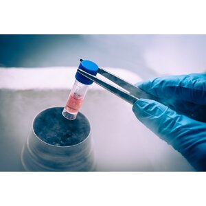 PLACENTA EXTRACTS FROM JAPAN