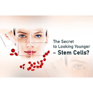 STEMCELL THERAPHY EXOXOMES