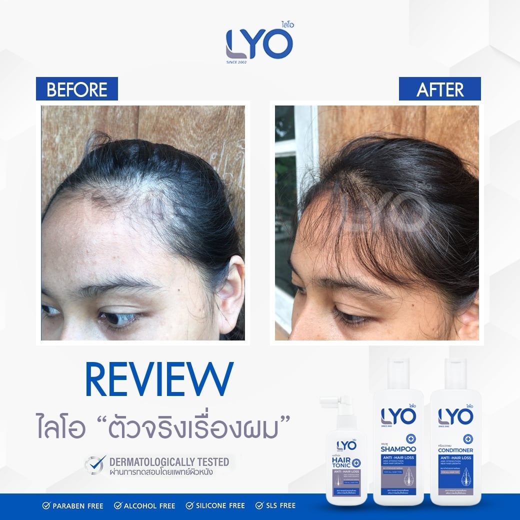 รีิวิวก่อนใช้ หลังใช้ไลโอ