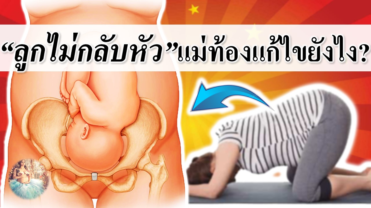“ลูกไม่กลับหัว” แม่ท้องแก้ยังไง?