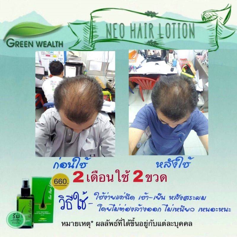 NeoHair นีโอแฮร์สเปรย์ สเปรย์ ผมยาว ผมร่วง ผมบาง ผมดกดำ