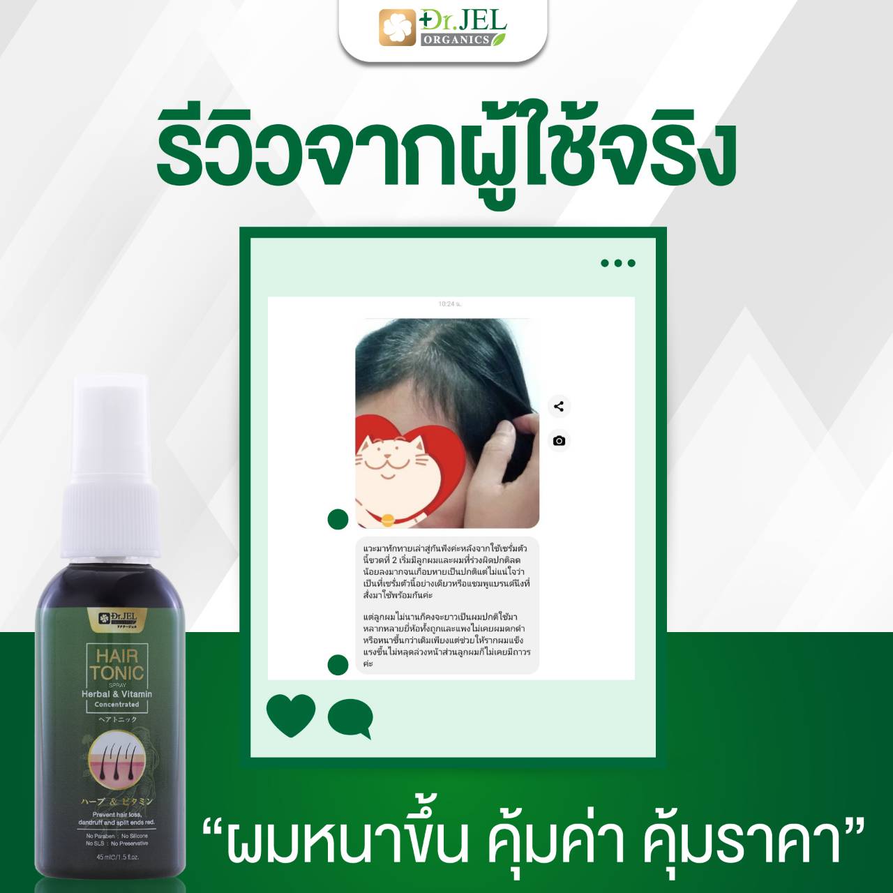 รีวิว ยาปลูกผม Dr.H 