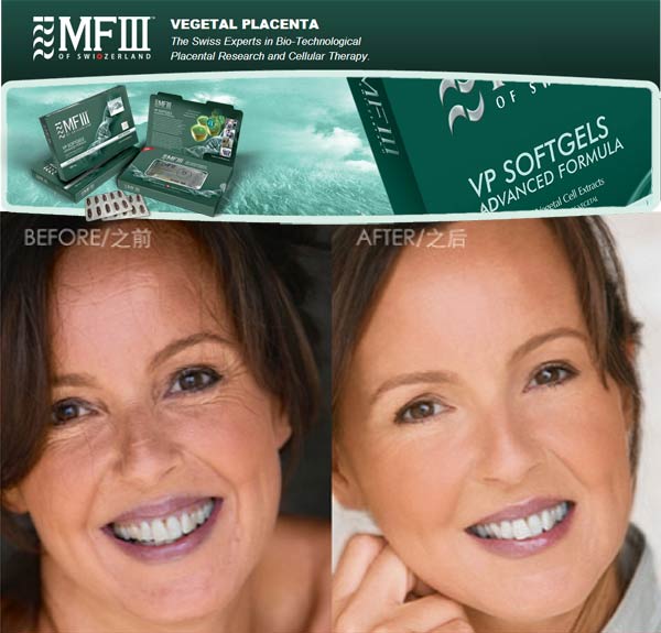 MF Plus VP TSRRP AF2 Total Skin Rejuvenation and Revitalization Program (Vegetal Placenta) Look And Feel Younger
