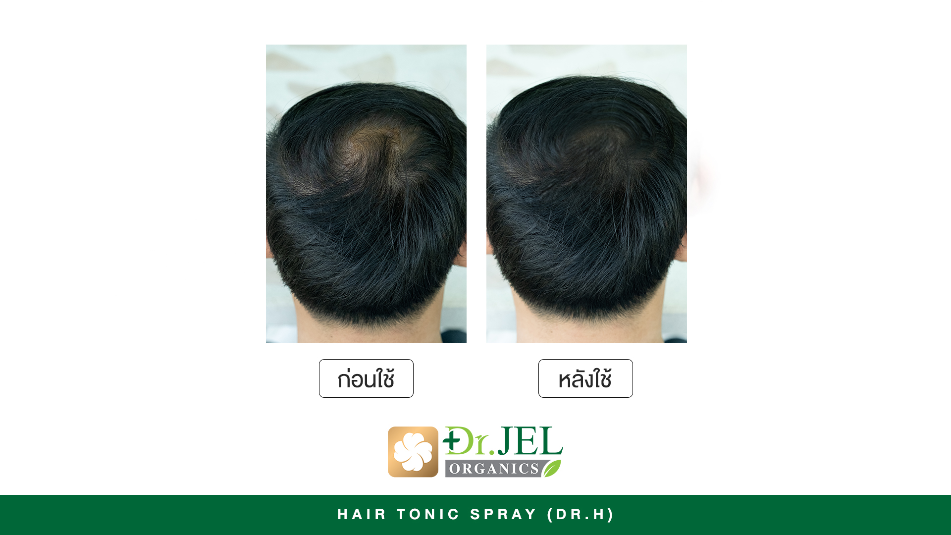 รีวิวเซรั่มปลูกผม Dr.H