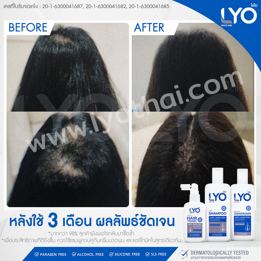 ไลโอ แฮร์โทนิค ฟรีแฮร์โทนิค