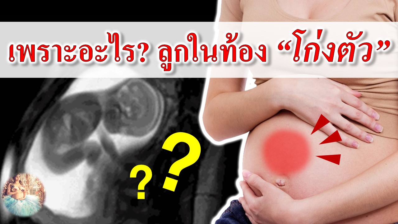 เพราะอะไร? ลูกในท้อง "โก่งตัว"