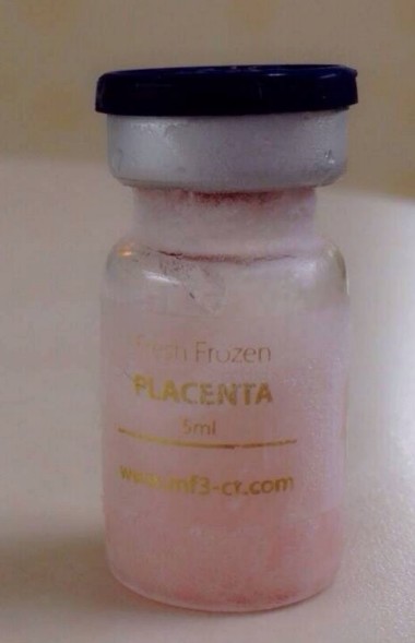 MF+ FFC FRESH FROZEN HUMAN PLACENTA เซลล์สด ขายเป็น vials ขวดเดียวอยู่แบบปัง ๆ ถึง 6 เดือน ราคาเบา ๆ 5ml.