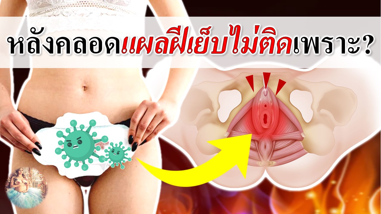 หลังคลอดแผลฝีเย็บไม่ติดกัน เพราะ?
