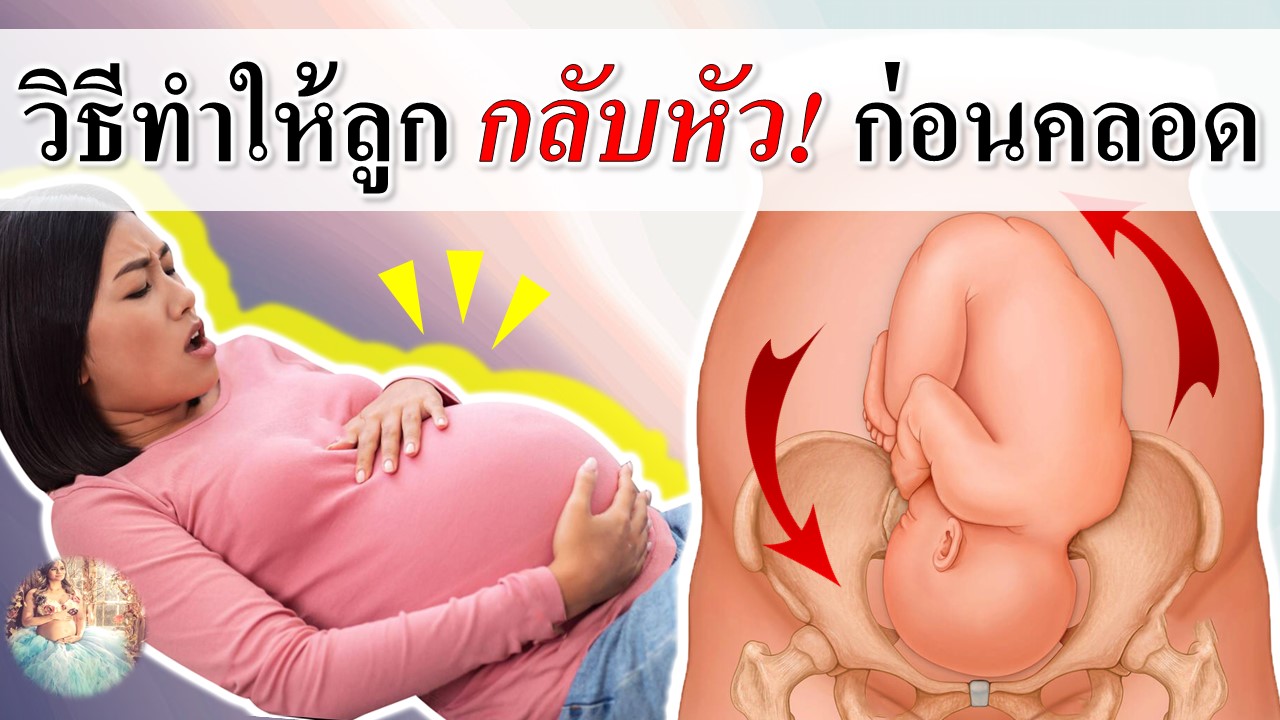 รวมวิธี ทำให้ลูกกลับหัวก่อนคลอด!
