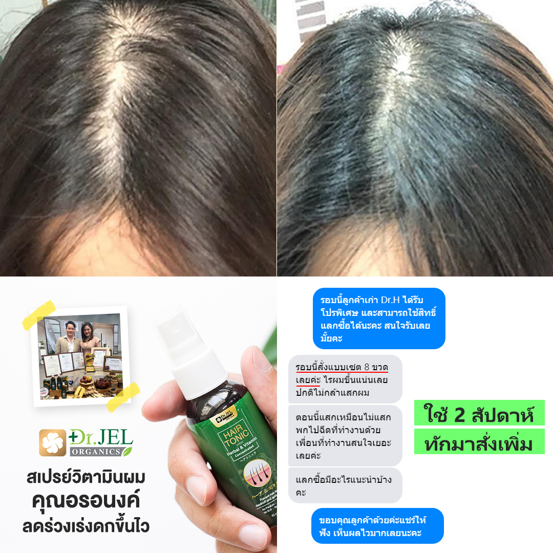 รีวิว เซรั่มปลูกผม dr.h 