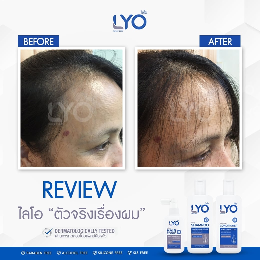 ไลโอ แฮร์โทนิค ฟรีแฮร์โทนิค