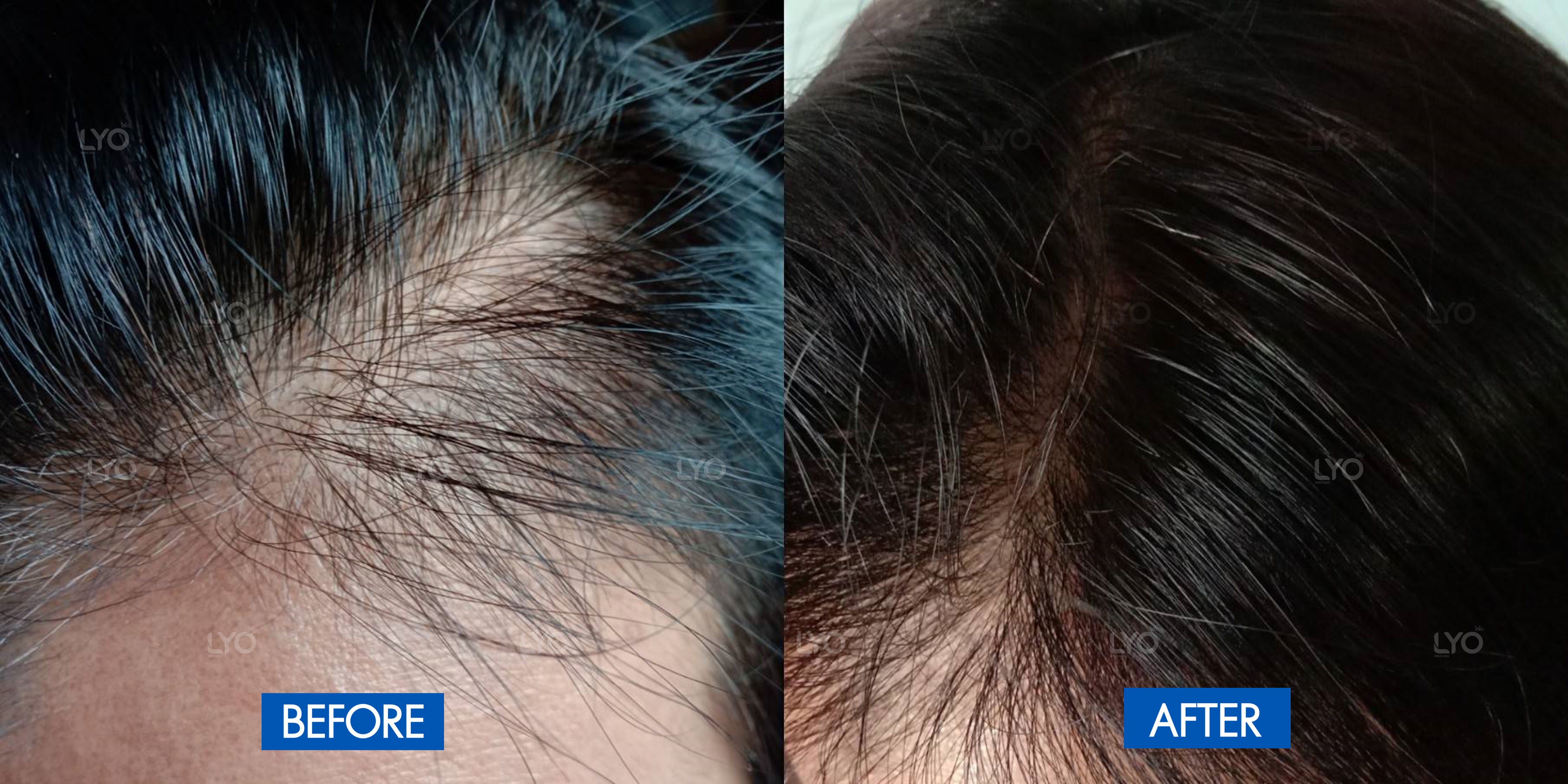 effective biotin