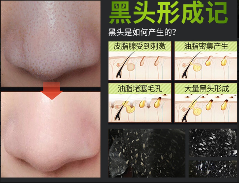 Yzkmskin Mark มาร์คลอกสิวเสี้ยวผงถ่านไม้ไผ่