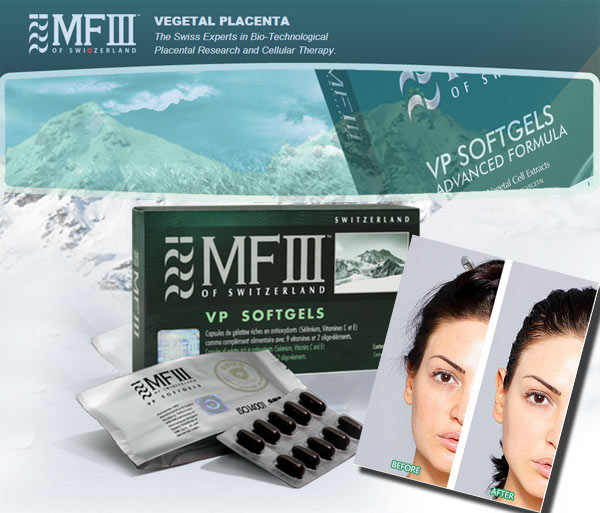 MF Plus VP TSRRP AF2 Total Skin Rejuvenation and Revitalization Program (Vegetal Placenta) Look And Feel Younger