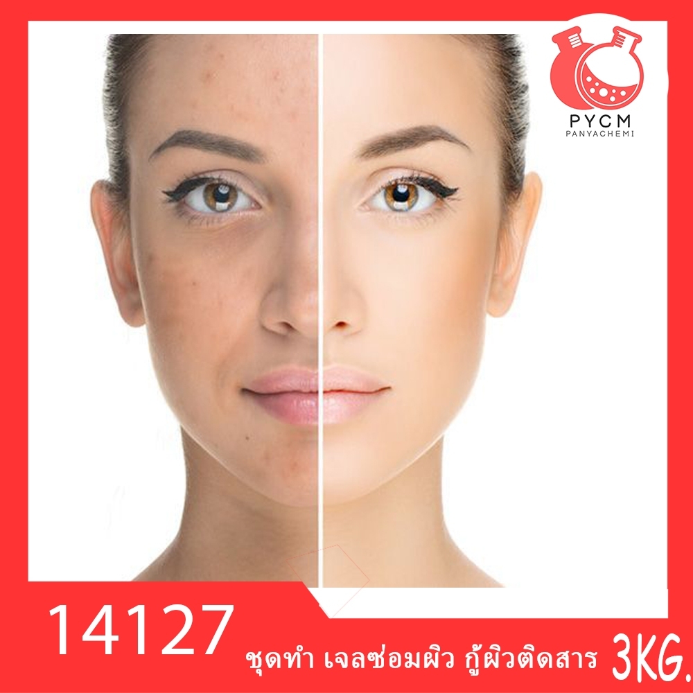 14127 PYCM-166 ชุดทำ เจลซ่อมผิว กู้ผิวติดสาร-3kg