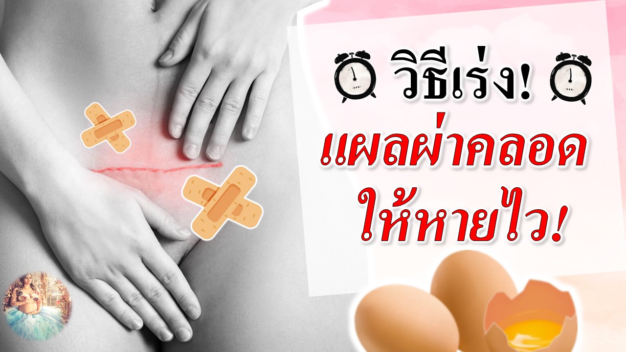 วิธีเร่งแผลผ่าคลอด ให้หายไว! วิธีเร่งแผลผ่าคลอด ให้หายไว!