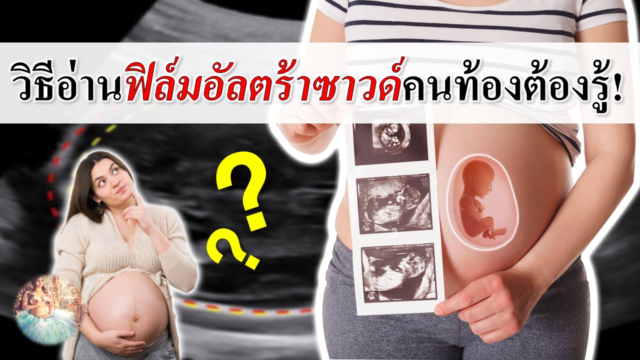 วิธีอ่านผลอัลตร้าซาวด์สำหรับแม่มือใหม่?
