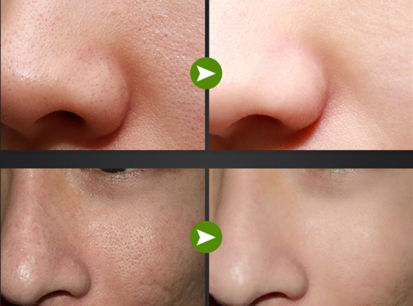 Yzkmskin Mark มาร์คลอกสิวเสี้ยวผงถ่านไม้ไผ่