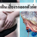 เตือนบำรุงเยอะเกิด ระวังรกลอกตัวก่อนกำหนด