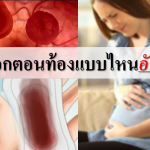 เลือดออกตอนท้องแบบไหนอันตราย
