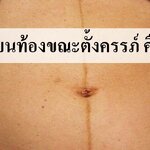 เส้นสีดำบนท้อง ที่เกิดขึ้นตอนตั้งครรภ์ คืออะไร ?