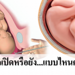 แม่ท้องควรรู้อาการแบบไหนเรียกปากมดลูกเปิด