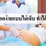 อยากคลอดง่ายแบบไม่เจ็บ ทำได้ไหมนะ!!