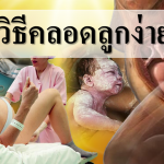 10 วิธีคลอดลูกง่าย