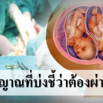 9 สัญญาณที่บ่งชี้ว่าต้องผ่าคลอด