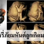 ควันบุหรี่ มหันตภัยลูกเกิดมาพิการ!!