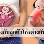ท้องแข็งกับลูกตัวโก่งต่างกันยังไง