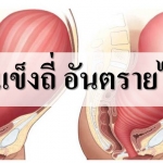 ท้องแข็งถี่ อันตรายไหม ทำยังไงให้หายท้องแข็ง...