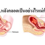 คลอดรก หลังคลอดลูกเป็นอย่างไรแม่ท้องต้องรู้!!