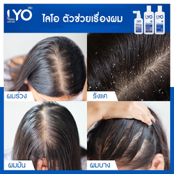 แชมพูไลโอ ลดการคันศีรษะที่เกิดจากรังแค