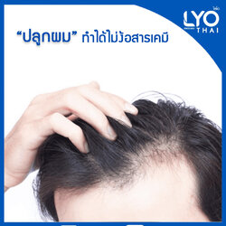 ปลูกผม ทำได้ไม่ง้อสารเคมี