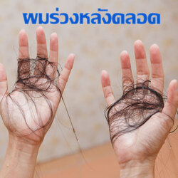 ผมร่วงหลังคลอด