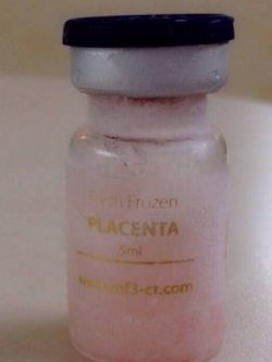 MF+ FFC FRESH FROZEN HUMAN PLACENTA เซลล์สด ขายเป็น vials ขวดเดียวอยู่แบบปัง ๆ ถึง 6 เดือน ราคาเบา ๆ 5ml.